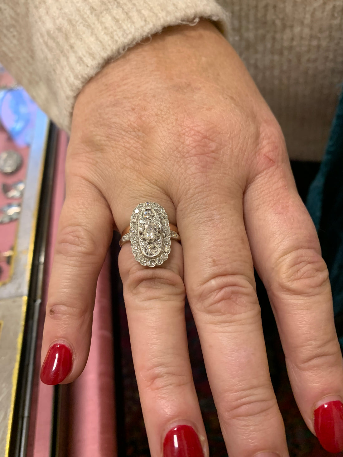 More Than a Ring: A Story of Resilience